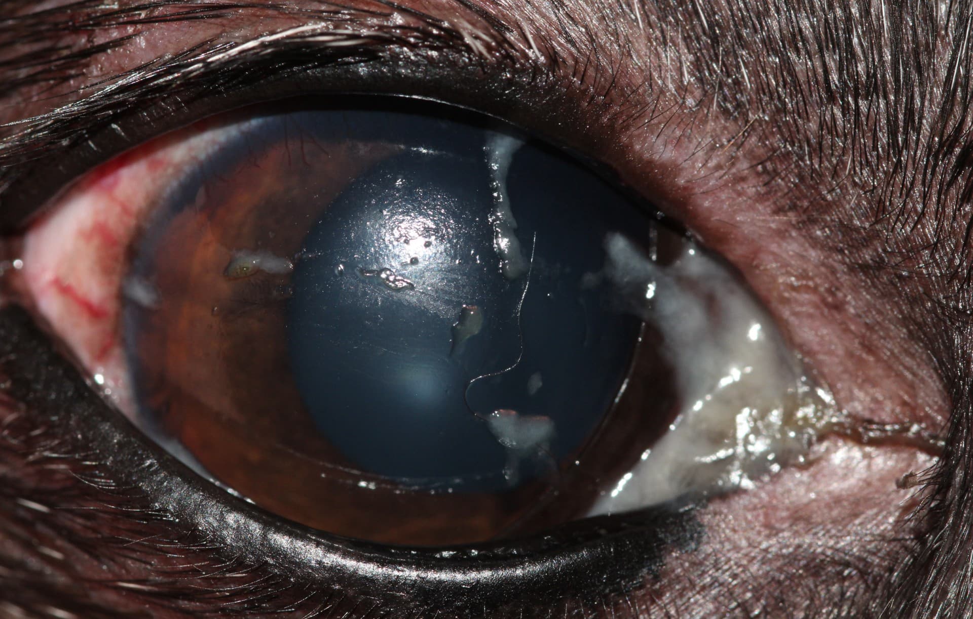 Years-associated dry eye (right)
