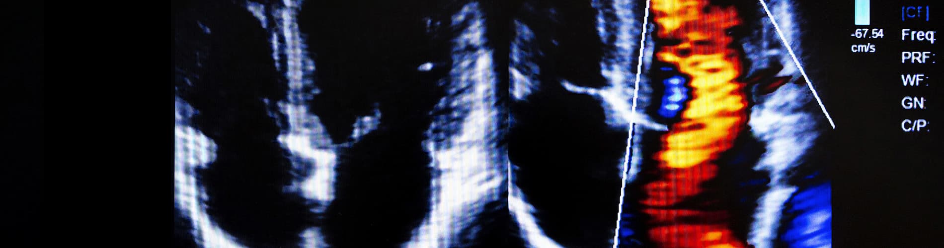 Next Steps Echocardiography_CourseHeader