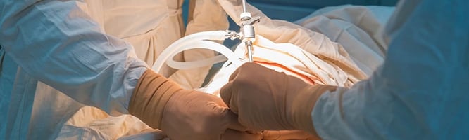 Tierärztliche Gastrotomie Schritt für Schritt