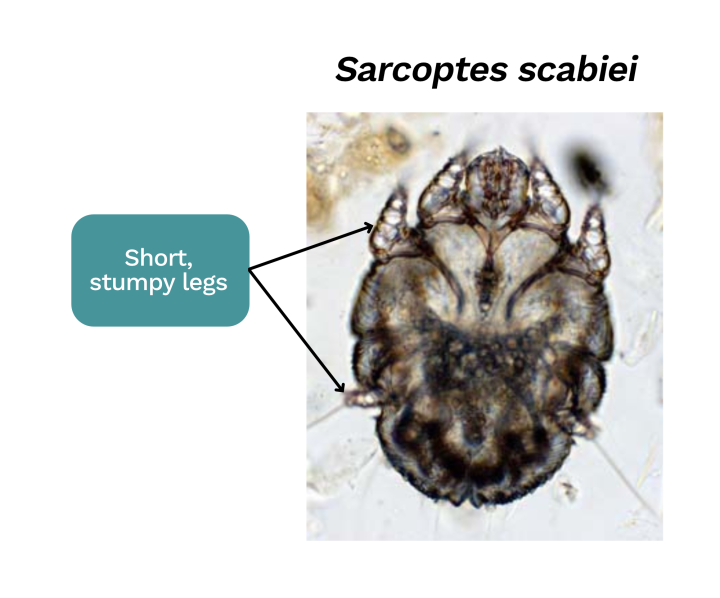 Sarcoptes mite microscopic image