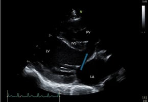 An echocardiogram of congenital heart disease in felines