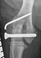 Fixing a humeral condyle fracture in a puppy