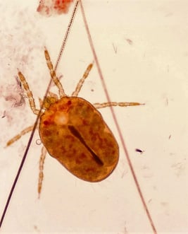 Neotrombicula autumnalis, or harvest mites