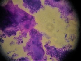 Malessezia on a feline sample