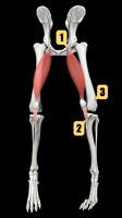 Canine medial patella luxation diagram