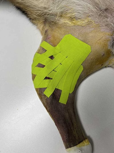 The double lymphatic pattern used