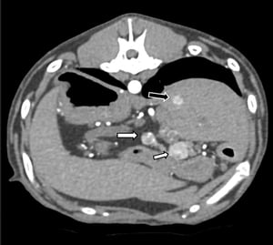 A CT scan of the abdominal region of a dog showing pancreatic nodules consistent with  insulinoma