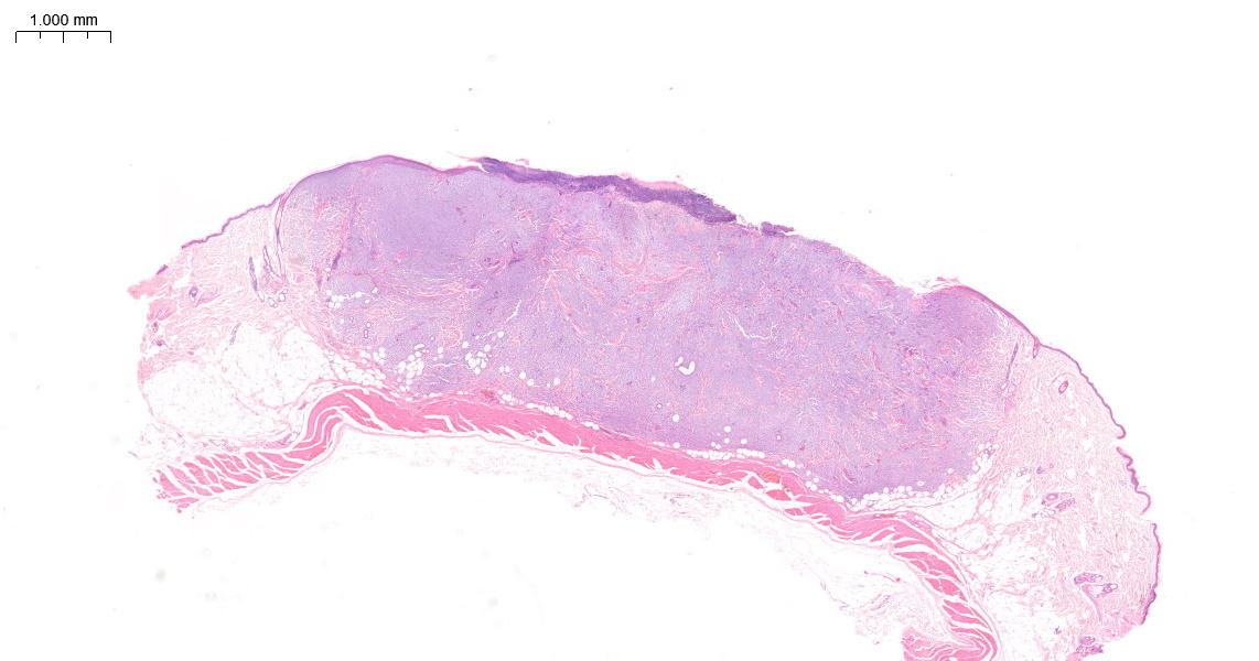 ferret mast cell tumour under microscope