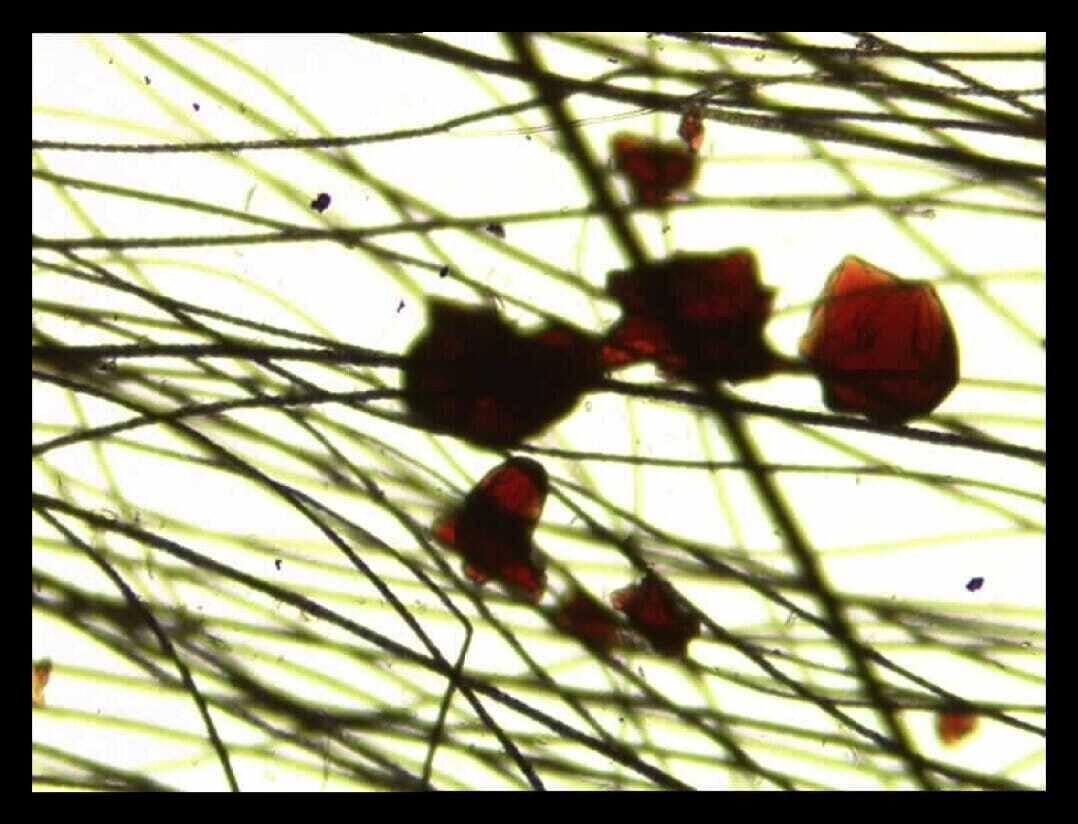 Flea faeces on coat brushing microscopy