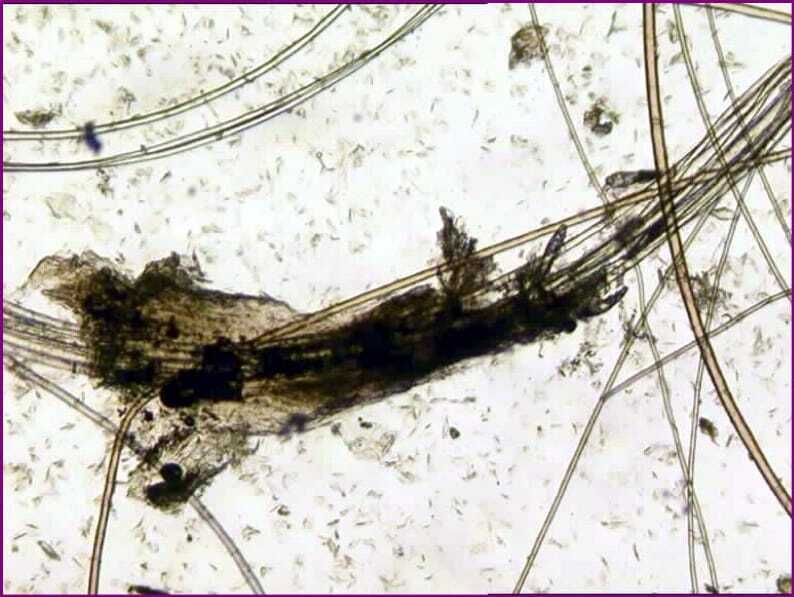 Microscopy of follicular casts from a canine demodicosis case