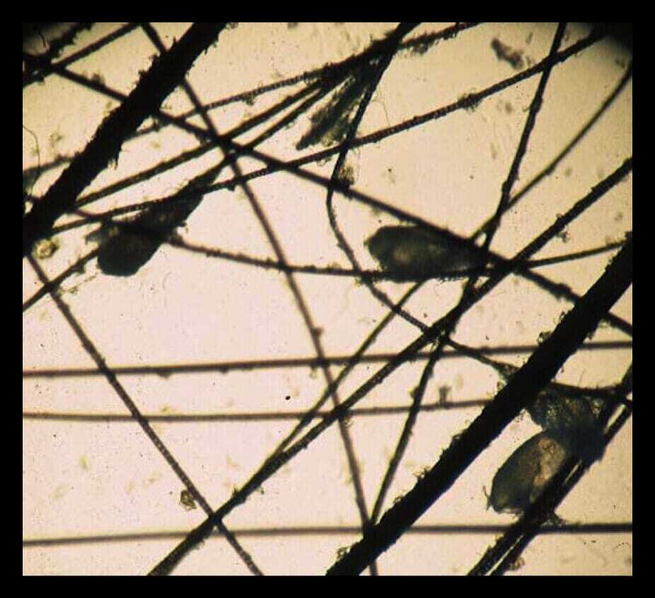 cheyletiella eggs on microscopy