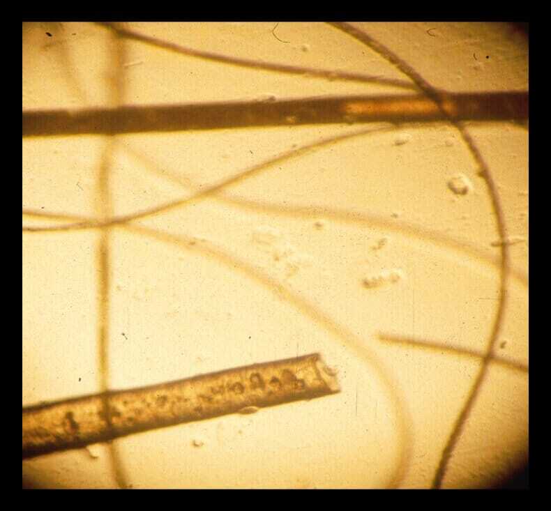 trauma to hairs suggesting pruritus in a feline atopy case
