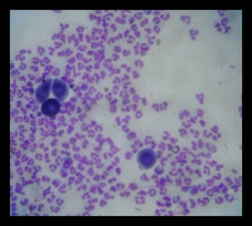 impression smear from ruptured pustule in canine pemphigus